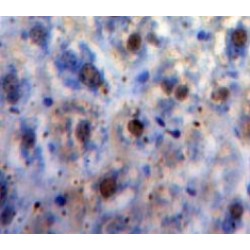 Transcription Factor p65 / NFKB3 (RELA) Antibody