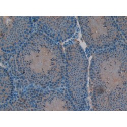 V-Rel Reticuloendotheliosis Viral Oncogene Homolog B (RELB) Antibody
