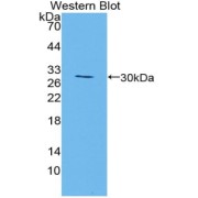 Western blot analysis of the recombinant protein.