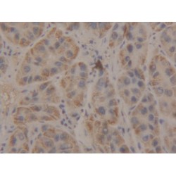 Beta-1,3-N-Acetylglucosaminyltransferase Manic Fringe (MFNG) Antibody