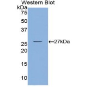 Western blot analysis of the recombinant protein.