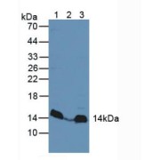 Western blot analysis of (1) Rat Heart Tissue, (2) Human Liver Tissue and (3) Mouse Liver Tissue.