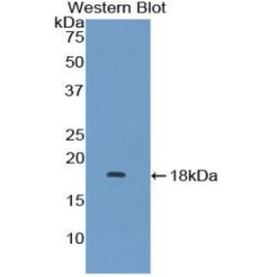 Ragulator Complex Protein LAMTOR3 / MAPKSP1 (LAMTOR3) Antibody