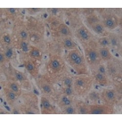 Phosphoinositide-3-Kinase Catalytic Beta Polypeptide (PIK3Cb) Antibody