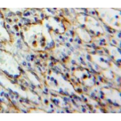 Signaling Threshold Regulating Transmembrane Adaptor 1 (SIT1) Antibody
