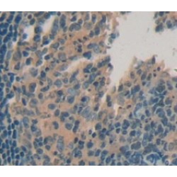 Tumor Necrosis Factor Ligand Superfamily Member 13 / CD256 (TNFSF13) Antibody