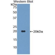 Western blot analysis of the recombinant protein.