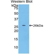 Western blot analysis of recombinant Mouse TNFSF14.