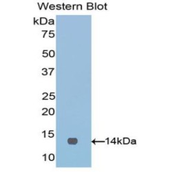 V-Set Domain Containing T-Cell Activation Inhibitor 1 (VTCN1) Antibody