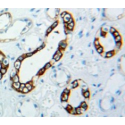 V-Set Domain Containing T-Cell Activation Inhibitor 1 (VTCN1) Antibody