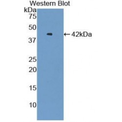 V-Set Domain Containing T-Cell Activation Inhibitor 1 (VTCN1) Antibody