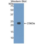 Western blot analysis of the recombinant protein.