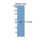 Western blot analysis of recombinant Human KLRD1.