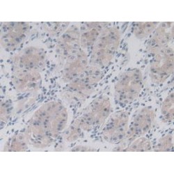 Natural Killer Cells Antigen CD94 (KLRD1) Antibody