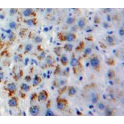 Oxidized Low Density Lipoprotein Receptor 1 (OLR1) Antibody