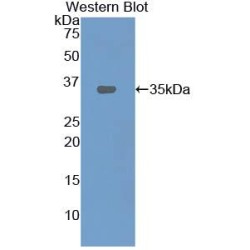 Oxidized Low Density Lipoprotein Receptor 1 (OLR1) Antibody