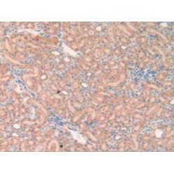 Oxidized Low Density Lipoprotein Receptor 1 (OLR1) Antibody