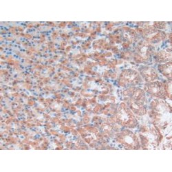 Oxidized Low Density Lipoprotein Receptor 1 (OLR1) Antibody