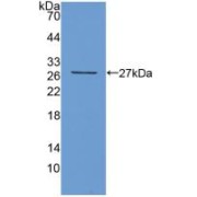 Western blot analysis of recombinant Mouse TIGIT.