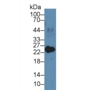 Western blot analysis of Pig Heart lysate, using Human MYL3 Antibody (3 µg/ml) and HRP-conjugated Goat Anti-Rabbit antibody (<a href="https://www.abbexa.com/index.php?route=product/search&amp;search=abx400043" target="_blank">abx400043</a>, 0.2 µg/ml).