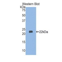 Myosin Light Chain 3 (MYL3) Antibody