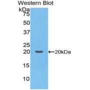 Western blot analysis of the recombinant protein.