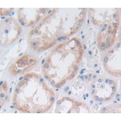 Tumor Necrosis Factor Related Apoptosis Inducing Ligand (TRAIL) Antibody