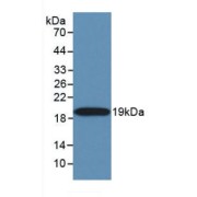 Western blot analysis of recombinant Human TRAIL.