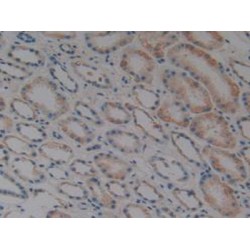 Tumor Necrosis Factor Related Apoptosis Inducing Ligand (TRAIL) Antibody