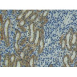 Tumor Necrosis Factor Related Apoptosis Inducing Ligand (TRAIL) Antibody