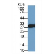 Western blot analysis of Human Lung lysate, using Human VAPA Antibody (1 µg/ml) and HRP-conjugated Goat Anti-Rabbit antibody (<a href="https://www.abbexa.com/index.php?route=product/search&amp;search=abx400043" target="_blank">abx400043</a>, 0.2 µg/ml).