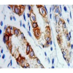 Vesicle Associated Membrane Protein Associated Protein A (VAPA) Antibody