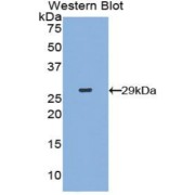 Western blot analysis of the recombinant protein.