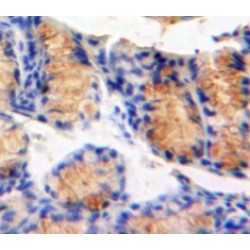 Mitogen Activated Protein Kinase Kinase Kinase Kinase 5 (MAP4K5) Antibody