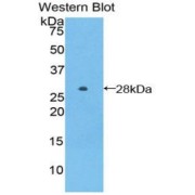 Western blot analysis of the recombinant protein.