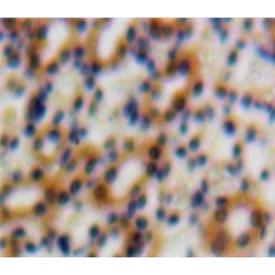 Transforming Growth Factor Beta 1 Induced Transcript 1 (TGFb1I1) Antibody