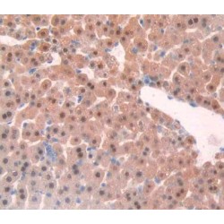 Tumor Necrosis Factor Receptor Superfamily Member 1A / CD120a (TNFRSF1A) Antibody