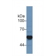 Western blot analysis of Rat Cerebrum lysate, using Rat TNFRSF1A Antibody (1 µg/ml) and HRP-conjugated Goat Anti-Rabbit antibody (<a href="https://www.abbexa.com/index.php?route=product/search&amp;search=abx400043" target="_blank">abx400043</a>, 0.2 µg/ml).