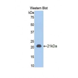 Tumor Necrosis Factor Receptor Superfamily Member 1A / CD120a (TNFRSF1A) Antibody