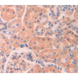 Tumor Necrosis Factor Receptor Superfamily Member 1A / CD120a (TNFRSF1A) Antibody