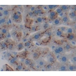 Tumor Necrosis Factor Receptor Superfamily Member 1B / CD120b (TNFRSF1B) Antibody