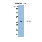 Western blot analysis of the recombinant protein.