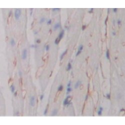 Tumor Necrosis Factor Receptor Superfamily Member 10B / DR5 (TNFRSF10B) Antibody