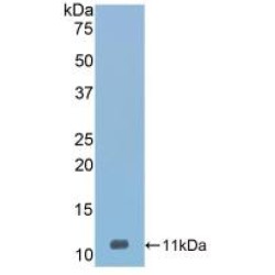 Serpin A12 (SERPINA12) Antibody