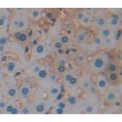 Serpin A12 (SERPINA12) Antibody