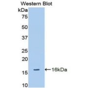 Western blot analysis of the recombinant protein.