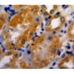 A Disintegrin And Metalloproteinase With Thrombospondin 1 (ADAMTS1) Antibody