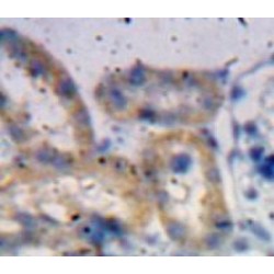 A Disintegrin And Metalloproteinase With Thrombospondin 1 (ADAMTS1) Antibody