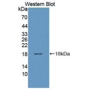 Western blot analysis of the recombinant protein.