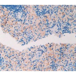 A Disintegrin And Metalloproteinase With Thrombospondin 1 (ADAMTS1) Antibody